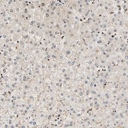 Invitrogen CDK7 Polyclonal Antibody 100 &mu;L; Unconjugated:Antibodies,