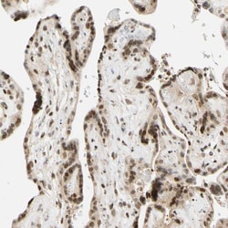 Invitrogen CDK7 Polyclonal Antibody 100 &mu;L; Unconjugated:Antibodies,