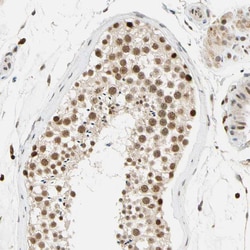 Invitrogen CDK7 Polyclonal Antibody 100 &mu;L; Unconjugated:Antibodies,