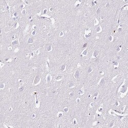 Invitrogen S100A4 Polyclonal Antibody 100 &mu;L; Unconjugated:Anticuerpos