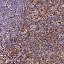 Invitrogen S100A4 Polyclonal Antibody 100 &mu;L; Unconjugated:Anticuerpos