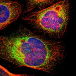 RAP Polyclonal Antibody:Antibodies, Polyclonal
