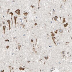 RAP Polyclonal Antibody:Antibodies, Polyclonal