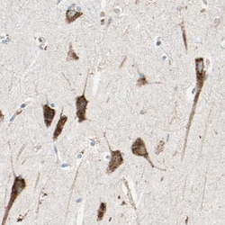 RAP Polyclonal Antibody:Antibodies, Polyclonal