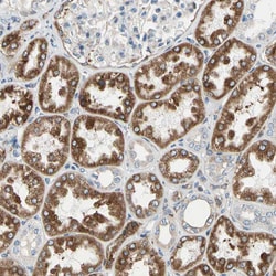 RAP Polyclonal Antibody:Antibodies, Polyclonal