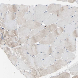 RAP Polyclonal Antibody:Antibodies, Polyclonal