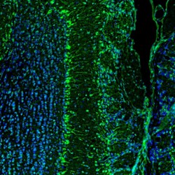RAP Polyclonal Antibody:Antibodies, Polyclonal