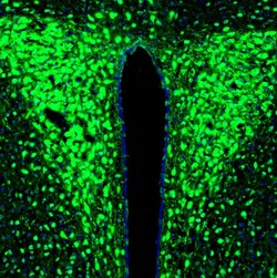 RAP Polyclonal Antibody:Antibodies, Polyclonal