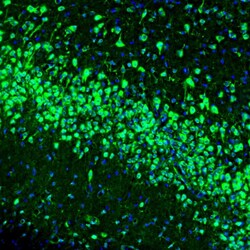 RAP Polyclonal Antibody:Antibodies, Polyclonal