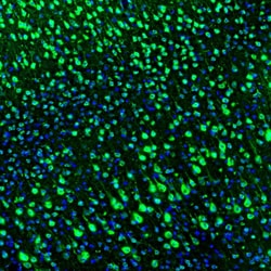RAP Polyclonal Antibody:Antibodies, Polyclonal