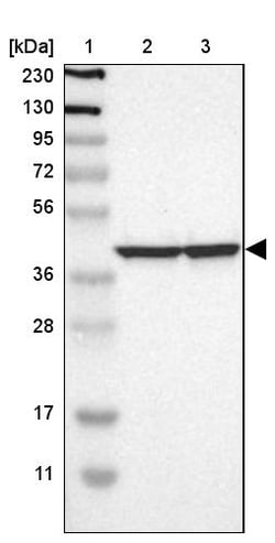 Invitrogen RAP Polyclonal Antibody 100 &mu;L; Unconjugated:Antibodies,