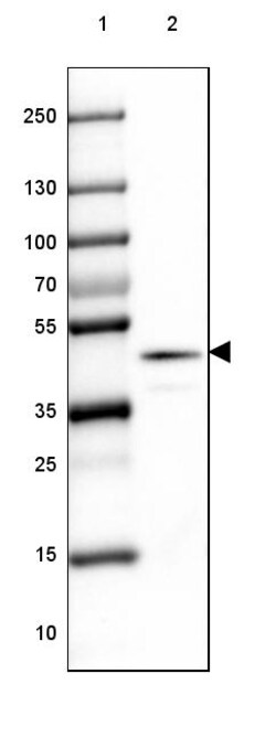 Invitrogen RAP Polyclonal Antibody 100 &mu;L; Unconjugated:Antibodies,