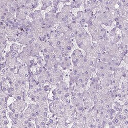 CLIC4 Polyclonal Antibody:Antibodies, Polyclonal