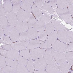 CLIC4 Polyclonal Antibody:Antibodies, Polyclonal