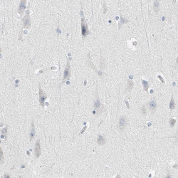 Invitrogen STK40 Polyclonal Antibody 100 &mu;L; Unconjugated:Antibodies,