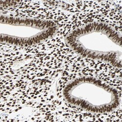 Invitrogen CDK12 Polyclonal Antibody 100 &mu;L; Unconjugated:Antibodies,