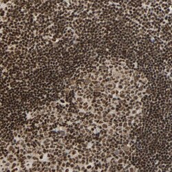 Invitrogen CDK12 Polyclonal Antibody 100 &mu;L; Unconjugated:Antibodies,