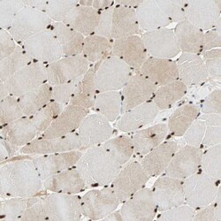 Invitrogen CDK12 Polyclonal Antibody 100 &mu;L; Unconjugated:Antibodies,