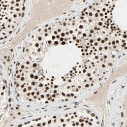 Invitrogen CDK12 Polyclonal Antibody 100 &mu;L; Unconjugated:Antibodies,