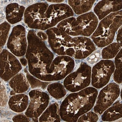 Invitrogen GM2A Polyclonal Antibody 100 &mu;L; Unconjugated:Antibodies,
