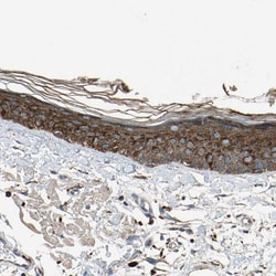 Invitrogen GM2A Polyclonal Antibody 100 &mu;L; Unconjugated:Antibodies,