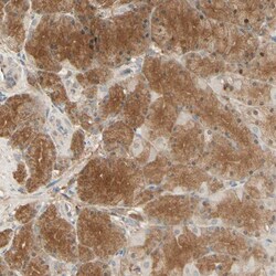 Invitrogen EphB3 Polyclonal Antibody 100 &mu;L; Unconjugated:Antibodies,