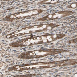 Invitrogen OXSR1 Polyclonal Antibody 100 &mu;L; Unconjugated:Antibodies,