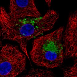 Invitrogen MUC5B Polyclonal Antibody 100 &mu;L; Unconjugated:Antibodies,