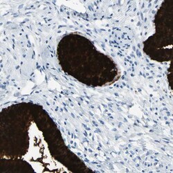 Invitrogen MUC5B Polyclonal Antibody 100 &mu;L; Unconjugated:Antibodies,