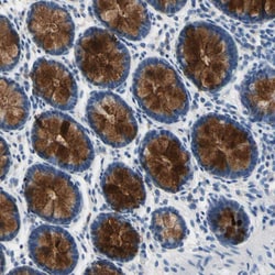 Invitrogen MUC5B Polyclonal Antibody 100 &mu;L; Unconjugated:Antibodies,
