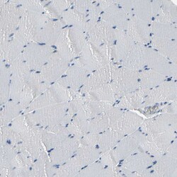 Invitrogen MUC5B Polyclonal Antibody 100 &mu;L; Unconjugated:Antibodies,