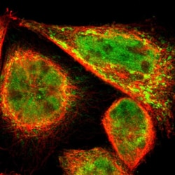 Invitrogen PDK2 Polyclonal Antibody 100 &mu;L; Unconjugated:Antibodies,