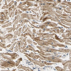 Invitrogen PDK2 Polyclonal Antibody 100 &mu;L; Unconjugated:Antibodies,