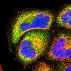 NFkB p100 Polyclonal Antibody:Antibodies, Polyclonal