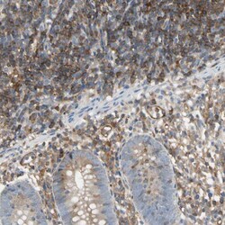 NFkB p100 Polyclonal Antibody:Antibodies, Polyclonal