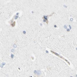 NFkB p100 Polyclonal Antibody:Antibodies, Polyclonal