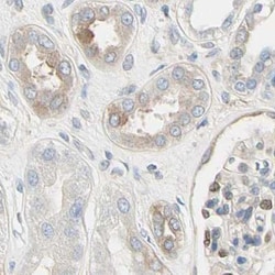 NFkB p100 Polyclonal Antibody:Antibodies, Polyclonal