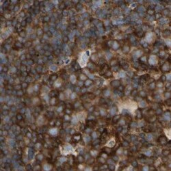NFkB p100 Polyclonal Antibody:Antibodies, Polyclonal