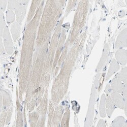 NFkB p100 Polyclonal Antibody:Antibodies, Polyclonal