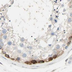 NFkB p100 Polyclonal Antibody:Antibodies, Polyclonal