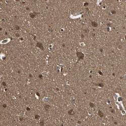 Invitrogen 14-3-3 epsilon Polyclonal Antibody 100 &mu;L; Unconjugated:Antibodies,