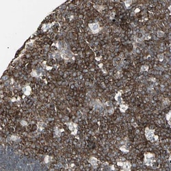 Invitrogen EPS15 Polyclonal Antibody 100 &mu;L; Unconjugated:Antibodies,