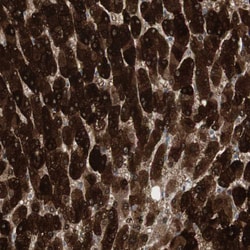 Invitrogen HGK Polyclonal Antibody 100 &mu;L | Buy Online | Invitrogen&trade; | Fisher Scientific