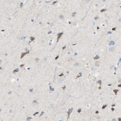 Invitrogen Carbonic Anhydrase XIV Polyclonal Antibody 100 &mu;L; Unconjugated:Antibodies,