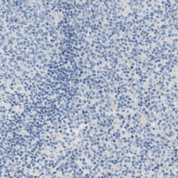 Invitrogen Carbonic Anhydrase XIV Polyclonal Antibody 100 &mu;L; Unconjugated:Antibodies,