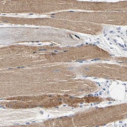 Invitrogen Carbonic Anhydrase XIV Polyclonal Antibody 100 &mu;L; Unconjugated:Antibodies,