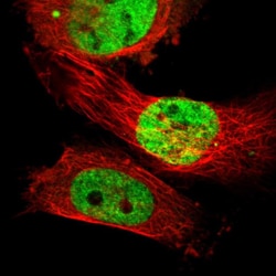 Invitrogen SUFU Polyclonal Antibody 100 &mu;L; Unconjugated:Antibodies,