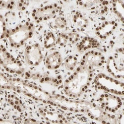 Invitrogen SUFU Polyclonal Antibody 100 &mu;L; Unconjugated:Antibodies,
