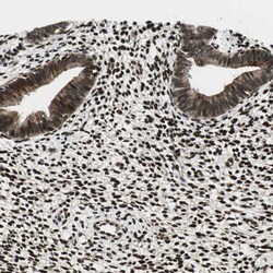 Invitrogen RING1 Polyclonal Antibody 100 &mu;L; Unconjugated:Antibodies,