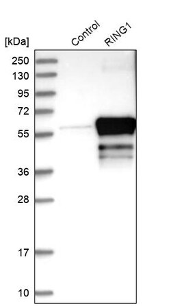 Invitrogen RING1 Polyclonal Antibody 100 &mu;L; Unconjugated:Antibodies,